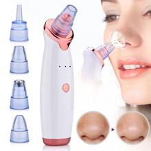 Blackhead Remover Pore Cleanser